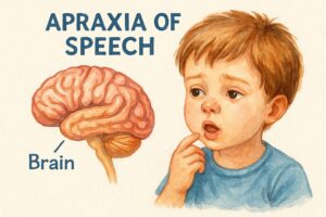 Speech therapy for apraxia of speech in children – Dubai clinic illustration